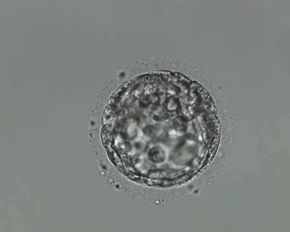 May embryo 2019
